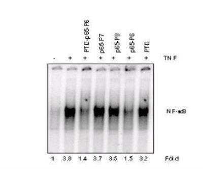 Western blots show p65 antibodies that passed the test of specificity